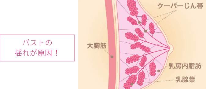 バストの揺れが原因